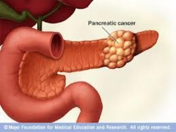 Descoperire Uluitoare, Corpul Se Vindeca Singur De Cancer