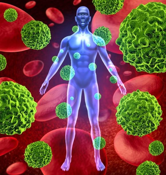 Care este alimentul din grădina ta care ucide 85% din celulele cancerului pulmonar?