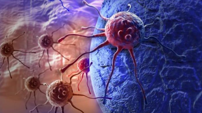 „Cancerul POATE FI TRATAT!” Anunt ISTORIC al oamenilor de stiinta!