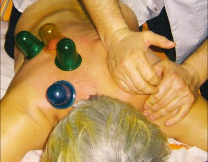 Terapia cu ventuze